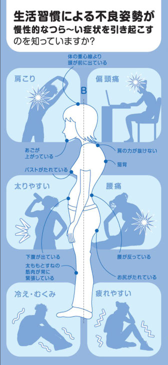 猫背・肩こり・腰痛