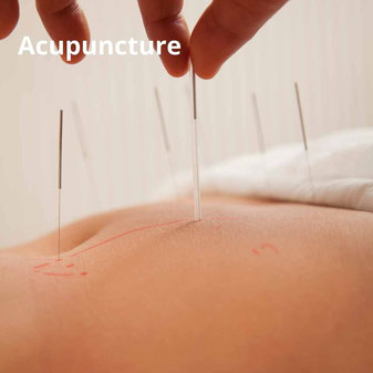 Acupuncture à Tours (37000), acupuncture à Monts - annuaire via energetica