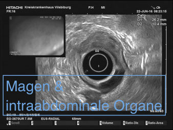 Endosonographie Normalbefund Magen, Darm, Milz, Nebenniere, Niere.