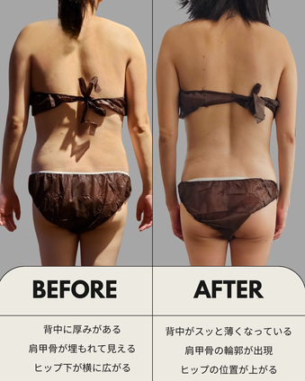 深部ファシア® ビフォーアフター