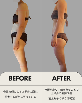 筋膜リリース ビフォーアフター