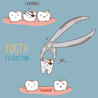 Tooth Pulled Gresham