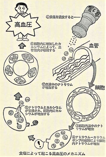 食塩によって起こる高血圧のメカニズム