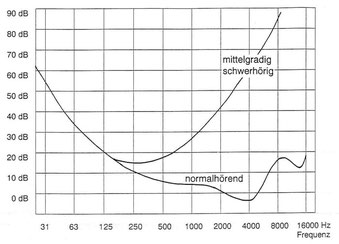 Diagramm Hörschwellenkurven guthörend und mittelgradig schwerhörend