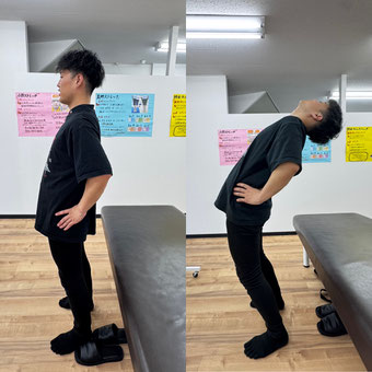 施術前と施術後の写真(後屈)