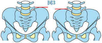 腸骨稜の高さ