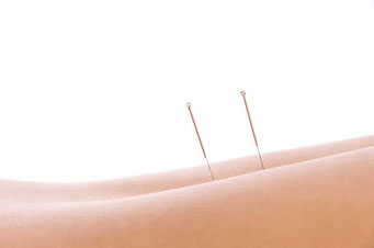 Acupuncture is a wonderful complementary method in the pain therapeutic treatment of disorders of the musculoskeletal system but also of stress-related disorders of the muscles, tendons, joints and bones. COPV Berlin