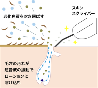 ソニックエステ・料金 - 茨城県つくば市フルール|お肌の悩みや ソニックエステ・料金 - 茨城県つくば市フルール|お肌の悩みや