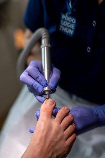 Eine Podologin bei der Arbeit eines Risikopatienten mit diabetischem Fuss. Die Fachpersonen bei Podologie Thun sind ausgebildet in Podologie EFZ und HF.