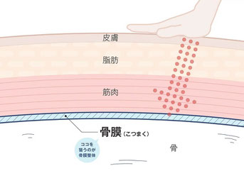 骨膜頭痛整体