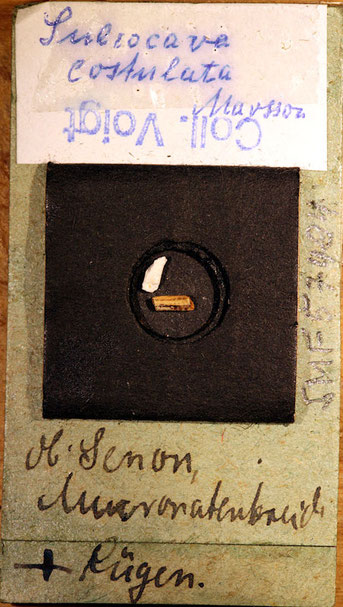 Senckenberg, Bryozoa, Bryozoen, Moostierchen, Sammlung Voigt