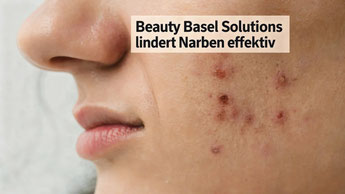Biopeeling mit Biopeel 