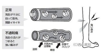 関節や筋肉の痛みに関わる血管のイメージイラスト（by新潟市の漢方薬専門店「西山薬局」）