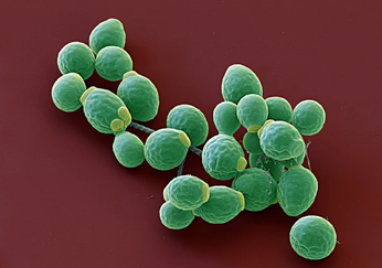 Die Hefe Candida albicans kann eine Rolle bei der Regulation des Immunsystems spielen. Quelle: Eye Of Science/SPL