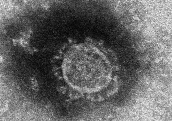 Dieses Elektronenmikroskopfoto, das vom National Institute of Infectious Diseases zur Verfügung gestellt wurde, zeigt das isolierte Coronavirus in der Einrichtung. (Foto: National Institute of Infectious Diseases)