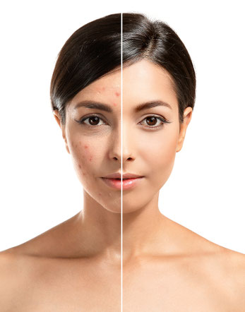 Glow Skin Gesichtsbehandlung Basel