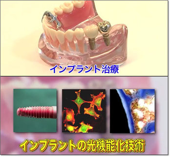 ↑画像をクリックしてください