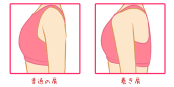 奈良県北葛城郡上牧町の肩こり女性