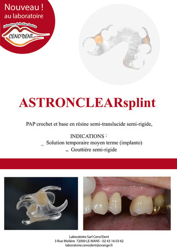 appareil provisoire, résine transparente, astron clear splint, adjointe