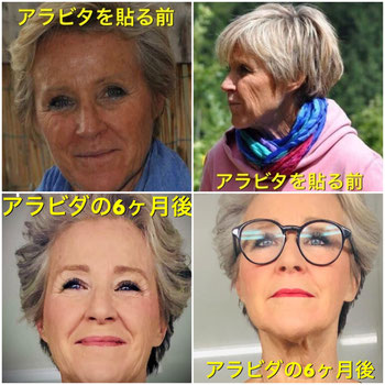 ライフウェーブ アラビダパッチ あかう ライフウェーブ アラビダパッチ あかう