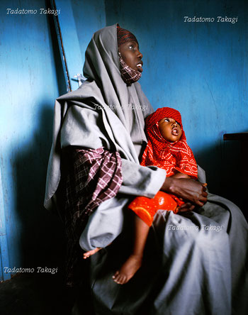 regional clinic, Somali's mother and daughter, 1/30 images