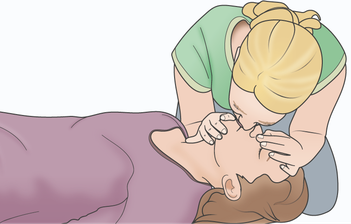 Illustration zur Mund zu Mund Beatmung, Beatmung, erste Hilfe