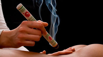 Eine Moxa Zigarre wird am unteren Rücken eingesetzt