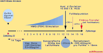 Schema: Ovarielle Stimulation nach dem "langen Protokoll"