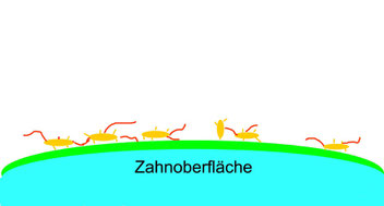 Bakterien lagern sich schnell auf dem Zahn ab.