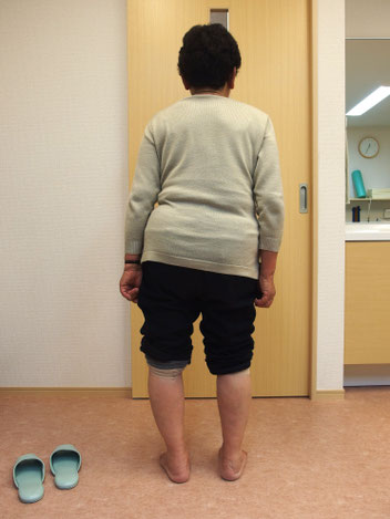 ③ 圧迫骨折の治療法 圧迫骨折治療 圧迫骨折 圧迫骨折高齢者 圧迫骨折の治し方 圧迫骨折やってはいけないこと 圧迫骨折治療法 腰椎圧迫骨折どのくらいで治る いつのまにか骨折 圧迫骨折後遺症 圧迫骨折 再発 圧迫骨折ほっとくとどうなる 腰椎圧迫骨折 胸椎圧迫骨折