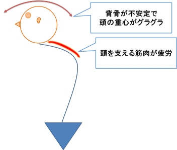 肩こりを起こす血行不良の原因に背骨の不安定性があげられます