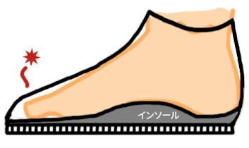インソールのつま先部分を薄くけずることで靴に当たらなくなりました