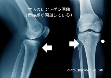 骨端線の閉鎖した大人のレントゲン画像