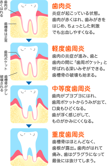 痛い 歯 食べ物 が 歯に良い食べ物知ってます？ 藤沢市