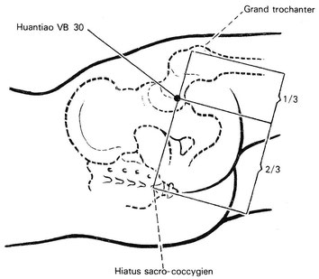 Localisation : Sur la face latérale de la fesse (dans le creux en arrière du grand trochanter) ; au tiers de la ligne qui relie le grand trochanter et le hiatus sacral. Point sensible à la pression.