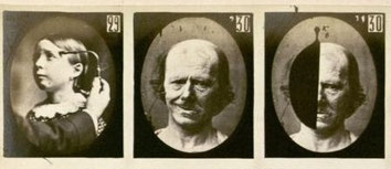 Bild aus: "Mécanisme de la Physionomie Humaine", 1862 von G. Duchenne