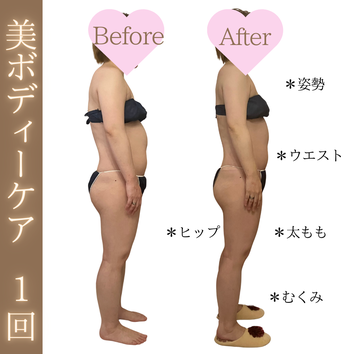 美ボディーケア ビフォーアフター