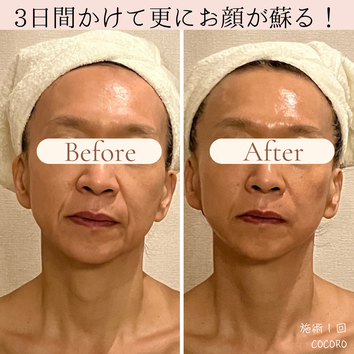 セルラム ビフォーアフター