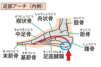 足部アーチの内側構造図。（足底腱膜、踵骨、舟状骨など）痛みが出やすい部位を青い円と赤い矢印で示している