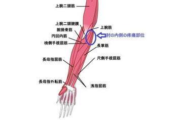 肘の内側の痛みに関連する前腕の筋肉群を示す解剖図（長掌筋、尺側手根屈筋、円回内筋など）