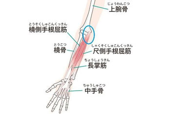 野球肘に関連する前腕の筋肉と骨格の解剖図