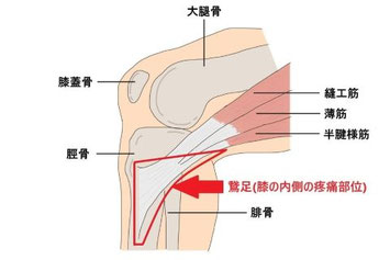 バレエによる膝の痛みが出る膝の内側の部位の解剖図（縫工筋、薄筋、半腱様筋の付着部分など）