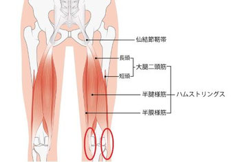 バレエによる膝の痛みが出る膝の後ろ側の部位の解剖図（大腿二頭筋、半腱様筋、半膜様筋の付着部分など）