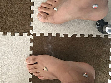 小牧 冷え 腰痛 自律神経失調症 鍼灸