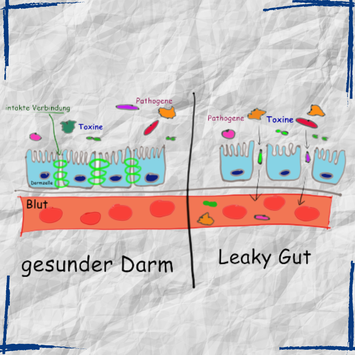 Leaky Gut- gestörte Darmbarriere