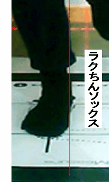 プロネーションの原因