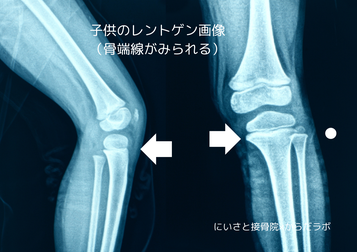骨端線が残っている子供のレントゲン画像