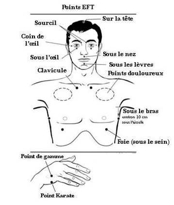 Points EFT - où sont les points sur le corps ?