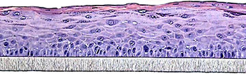 in vitro (SkinEthic HGE)