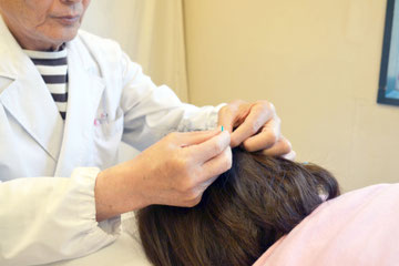 脱毛症・薄毛治療（育毛 増毛）の様子